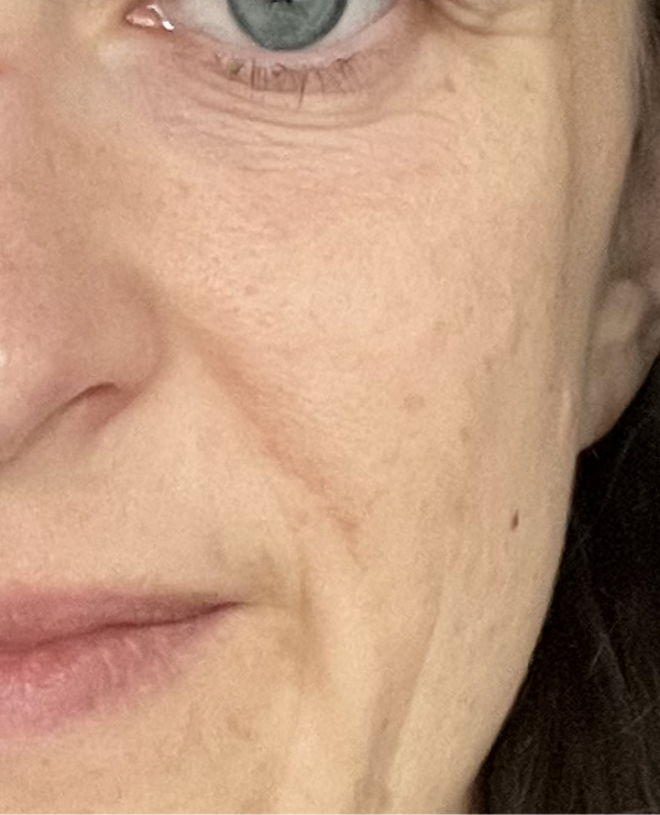 Vorher – Maria S.